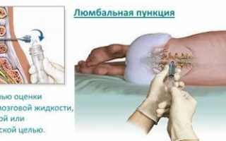 Взяли пункцию болит спина