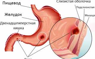 Болит вверху живот слева и спина