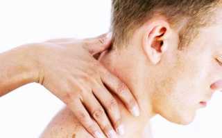 Болит голова каждый день ломит голову