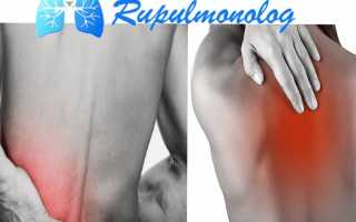 Почему при чихании болит спина