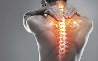 Болит ли спина при остеохондрозе