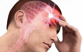 Справа в голова болит сосуд