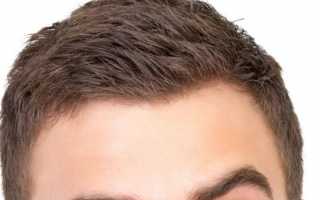 Болит голова в районе правой брови