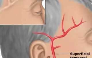 Почему болит голова с правой стороны и висок