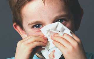 Сопли с кровью и болит голова