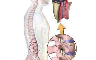 Если болит правая сторона спины что это может быть