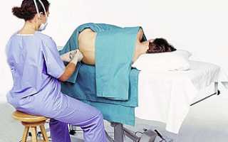 После пункции костного мозга болит спина