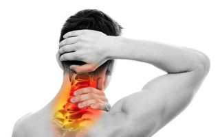 Защемление шейного позвонка болит голова