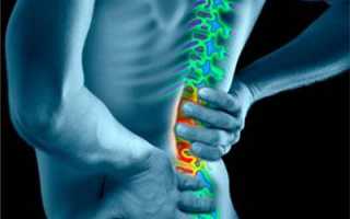 Если болят паха и спина