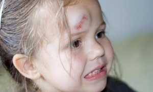 После падения болит голова к какому врачу обратиться