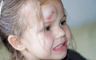 После падения болит голова к какому врачу обратиться