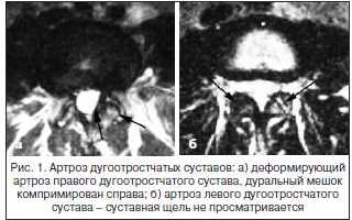 Почему болит спина у пожилых