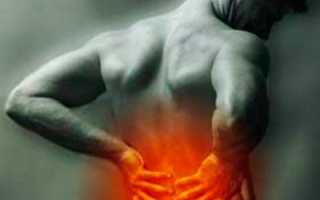 При движении болит спина снизу