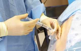 Сколько времени болит голова после операции