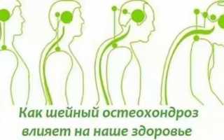 Болит место соединения головы и шеи что это может быть