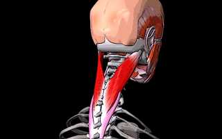 Постоянно болят мышцы шеи и голова