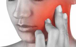 Если болит голова и немеет челюсть