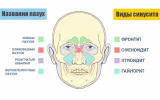 После гриппа заложен нос и болит голова