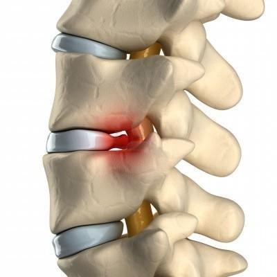 если болят паха и спина