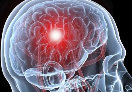 Голова болит кружиться слабость