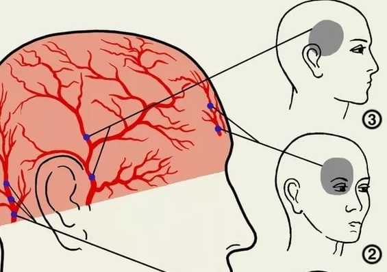 Все время болит голова глаза