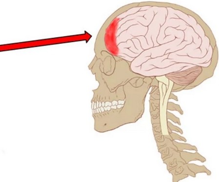 Когда болит лобная часть головы