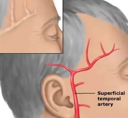 Болит голова где правый висок