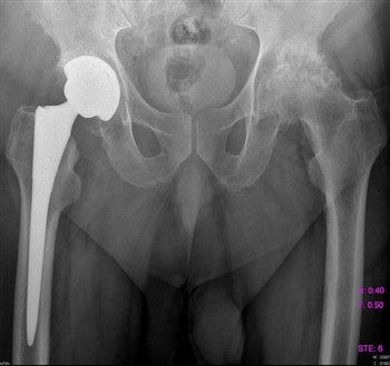 если болят паха и спина