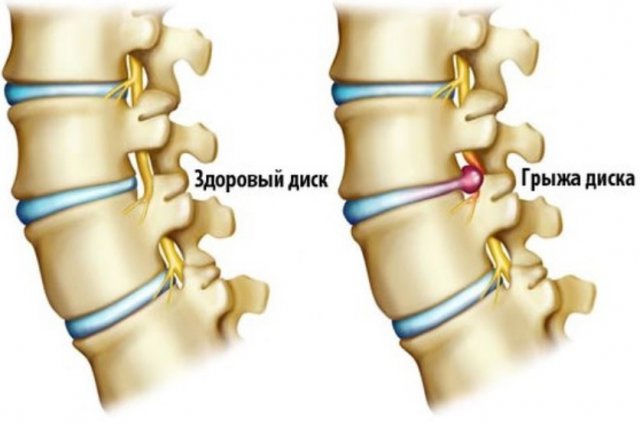Когда делаю вздох болит спина