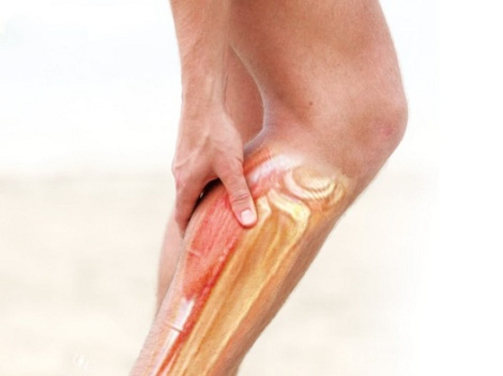 При беременности сильно болят ноги и спина в ранних сроках