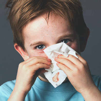 Сопли с кровью и болит голова