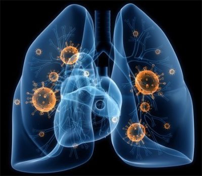 Если болит справа в боку и отдает в спину