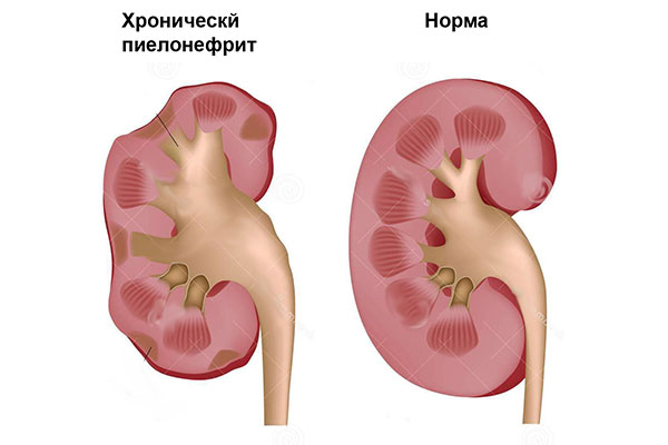 Болит спина рано утром