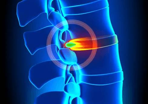 болит лопатка спина рука шея