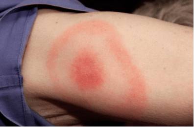 болят ноги и голова слабость 2я неделя