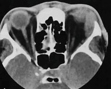 При температуре может болеть спина