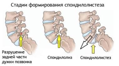 болит спина в области ночью