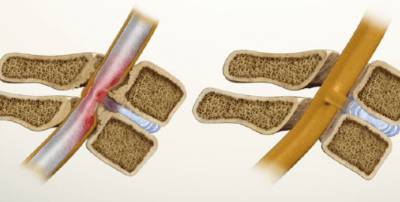 если болят паха и спина