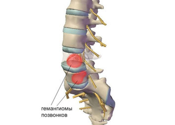 Когда делаю вздох болит спина
