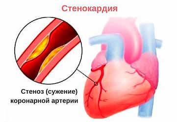 Когда делаю вздох болит спина