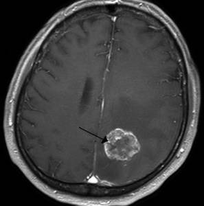 болят ноги и голова слабость 2я неделя