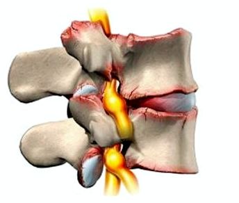 болит спина в области ночью