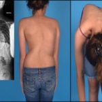 Болит грудная клетка отдает в спину больно дышать