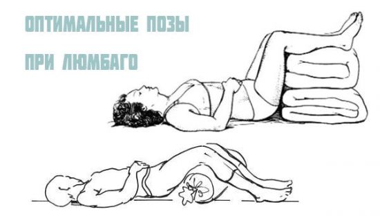 Позы при люмбаго